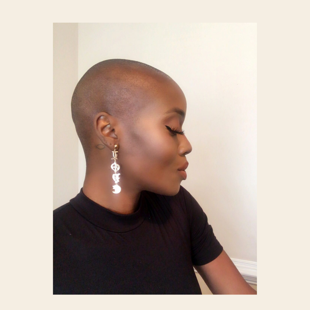 Alopecia – Causes and Treatment