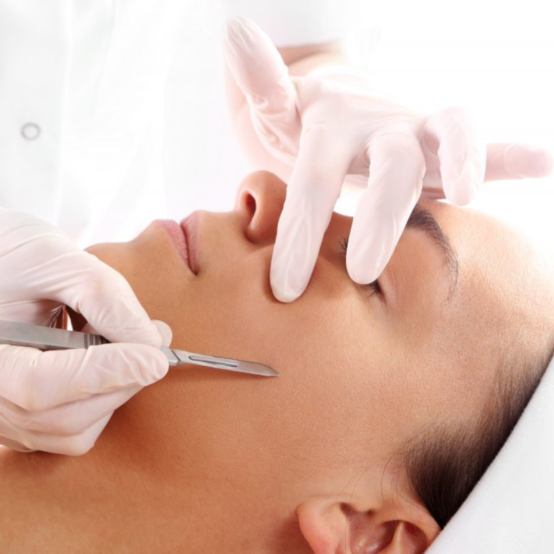 Hyperpigmentation – Causes and Treatment