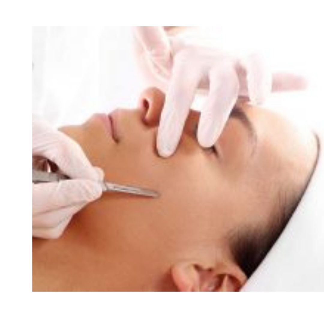 Dermaplaning (process and benefits)