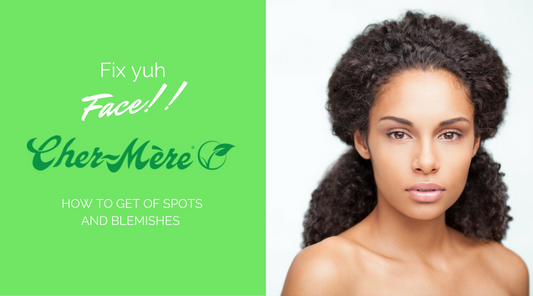 Natural Methods to Help Minimize Spots and Blemishes
