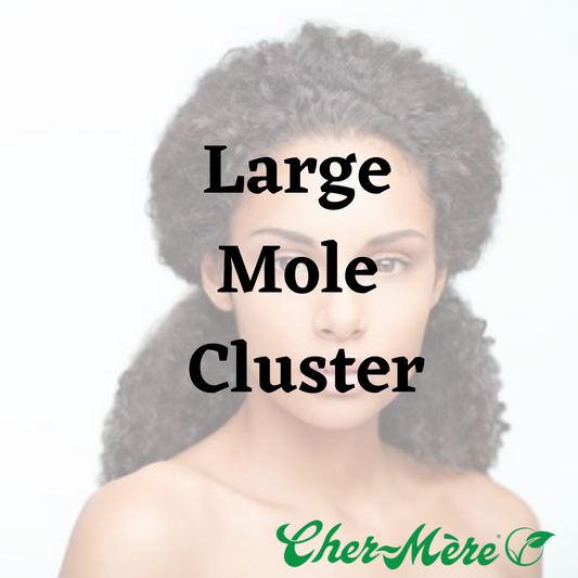 Large Mole Cluster