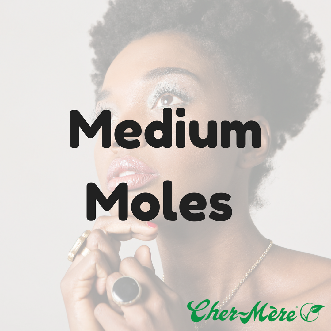 Medium Mole Removal - Cher-Mere