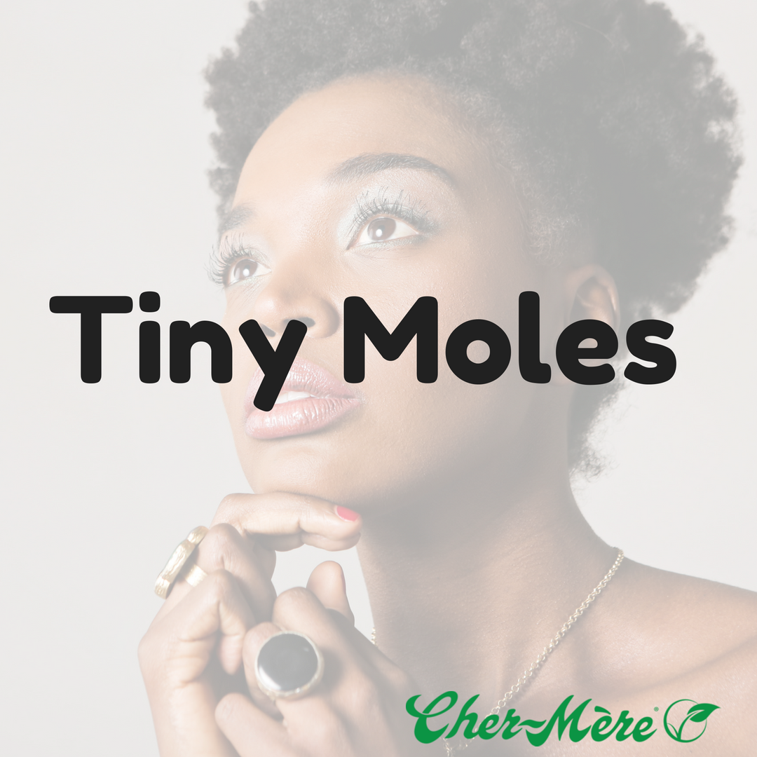 Tiny Moles - Cher-Mere