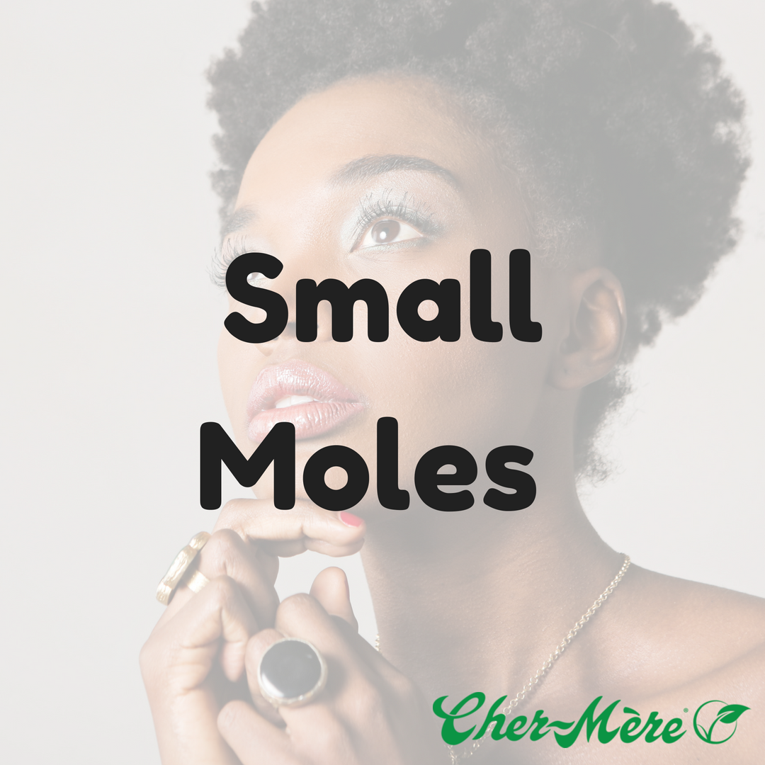 Small Moles - Cher-Mere